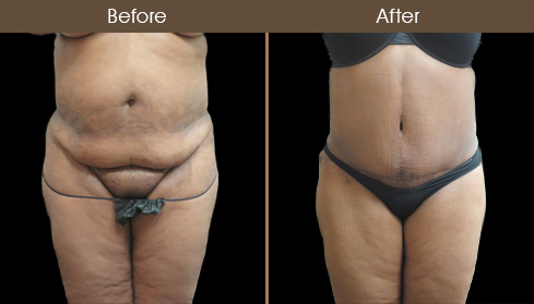 20202805171944_B101-Front